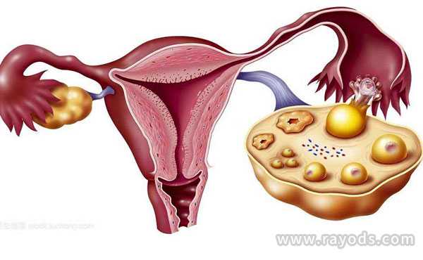 人工授精怎么促排卵？降低促排卵途中做好这3件事就好